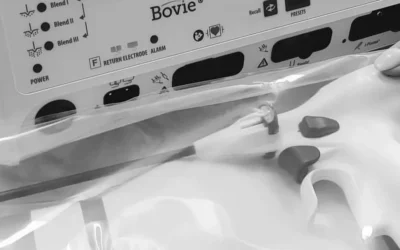 Renuvion J-Plasma : 6 choses à savoir